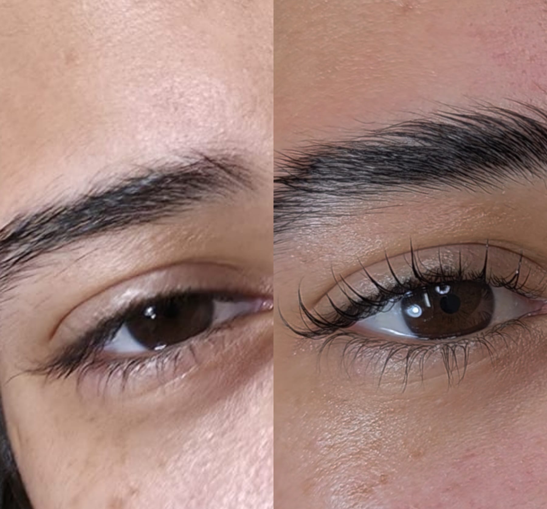 לפני ואחרי - שיקום גבות