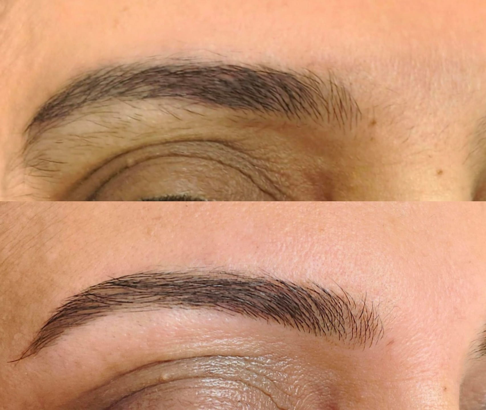 לפני ואחרי - שיקום גבות